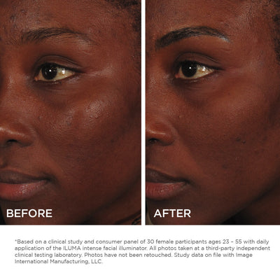 ILUMA Intense Face Illuminator 30ml