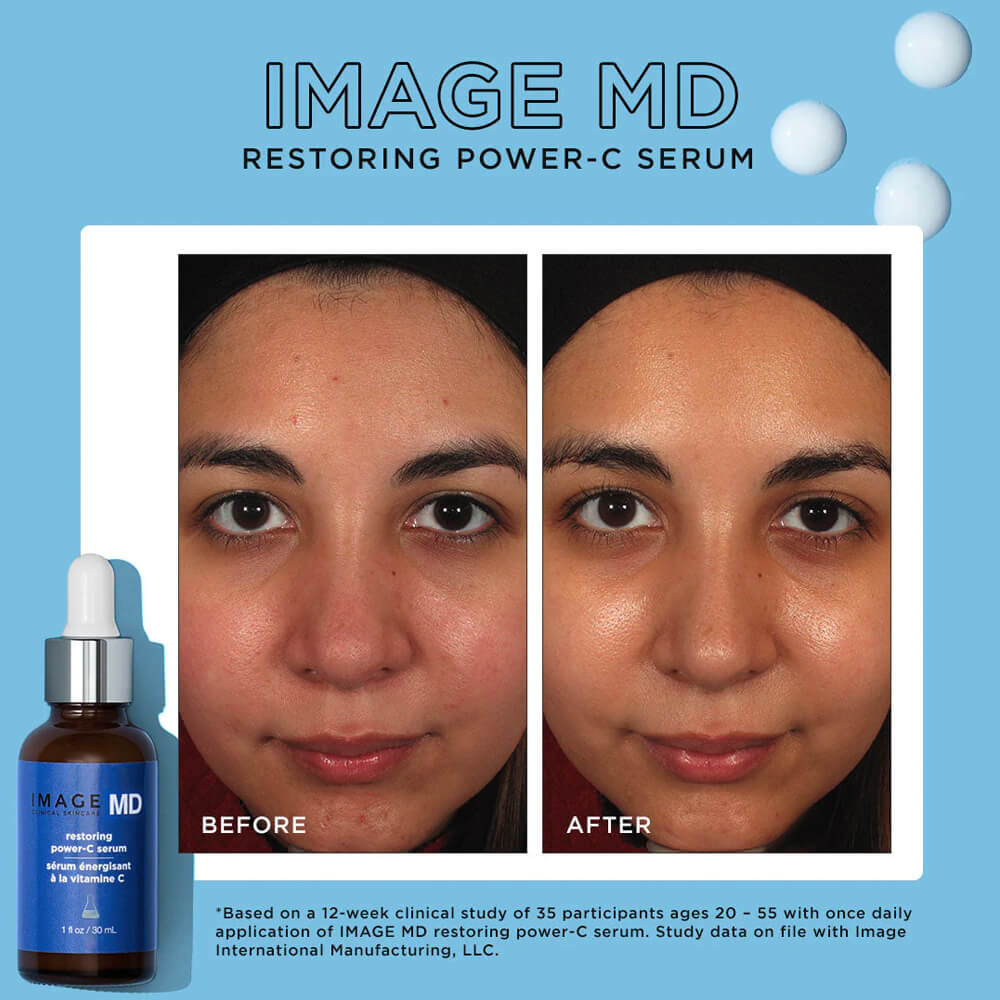 MD Sérum Énergisant à la Vitamine C 30ml